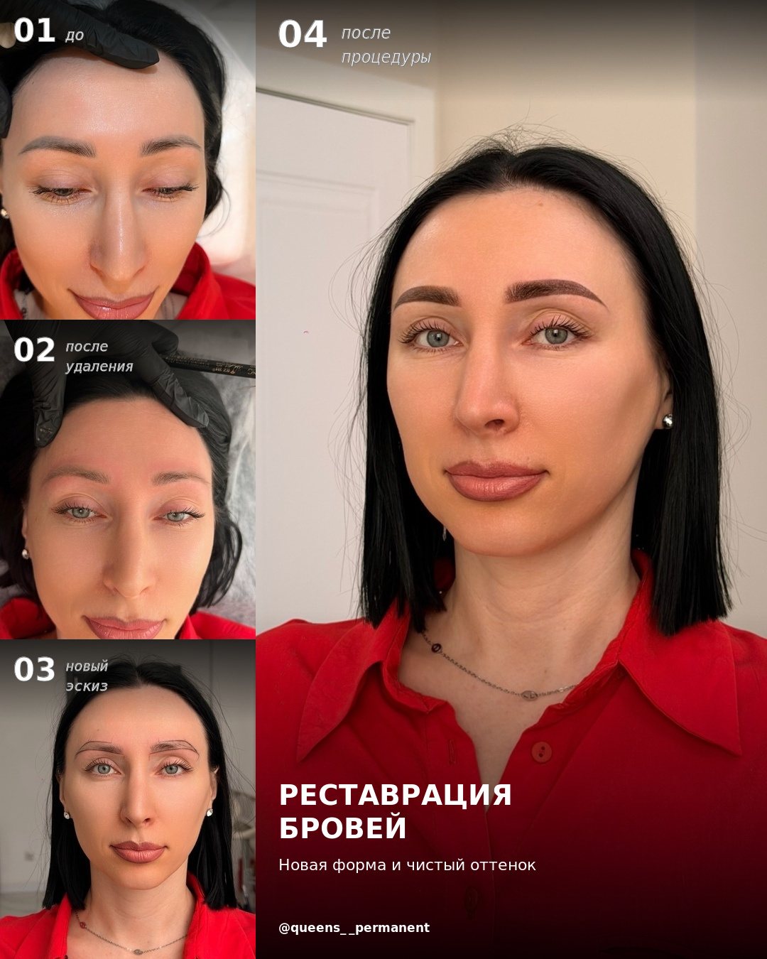 Реставрация бровей: до, после удаления, новый эскиз и после процедуры