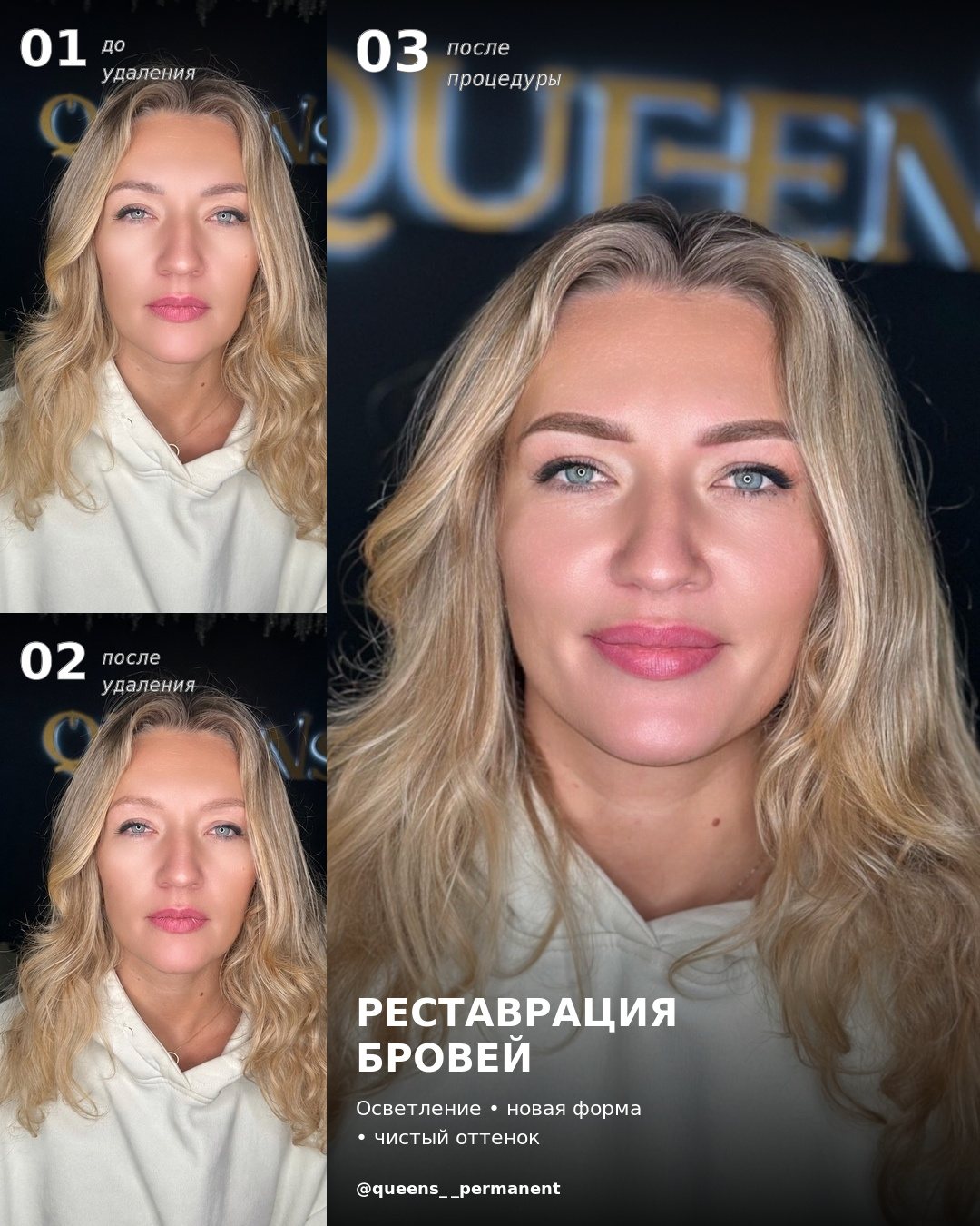 Реставрация бровей: до удаления, после удаления и после процедуры